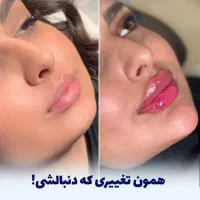 برداشتن خال،ژل،بوتاکس،انزیم،مزوکلنیک ایرانیان|خدمات آرایشگری و زیبایی|کرمانشاه, |دیوار