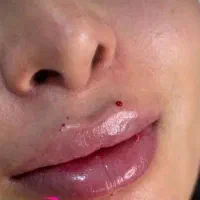 تخفیف یلدایی کلینیک سدنا