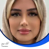 جراحی بینی با قیمت استثنایی