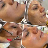فیشیال پاکسازی پوست/کاشت مژه هیدت/لیفت ابرو و مژه