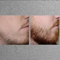 ریش فول، استایل ورزشکاری