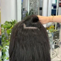 پروتیین /احیاه مو /رایگان/