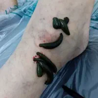 طب سنتی