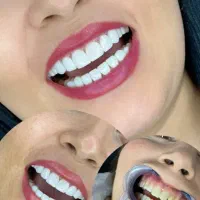 کامپوزیت 20تومنی|خدمات آرایشگری و زیبایی|بروجرد, |دیوار