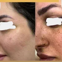 کرم معجزه اصلی تضمینی جوابدهی سریع|آرایشی، بهداشتی، درمانی|شیراز, کوشک میدان|دیوار