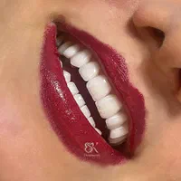 خدمات دندانپزشکی لمینت دندان کامپوزیت ودرمانی|خدمات آرایشگری و زیبایی|تهران, فلسطین (میدان انقلاب)|دیوار