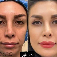 جراحی صورت ۵۰درصد تخفیف|خدمات آرایشگری و زیبایی|تهران, دروس|دیوار
