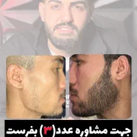 ریش پرپشت و مردونه