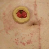 تزریقات و سرم تراپی در منزل|خدمات آرایشگری و زیبایی|خوی, |دیوار