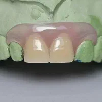 لابراتوار دندانسازی 3dental