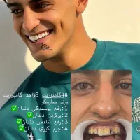 آموزش صفر تا صد کامپوزیت