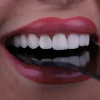 دندانپزشکی ایمپلنت کامپوزیت|خدمات آرایشگری و زیبایی|تهران, صادقیه|دیوار
