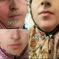 روغن و ا‌کسیر سلامتی|آرایشی، بهداشتی، درمانی|اراک, |دیوار