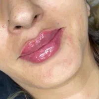 فیلر سی سی (۳۹۹)