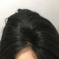 پوستیژ توردار|آرایشی، بهداشتی، درمانی|قرچک, داوود آباد|دیوار