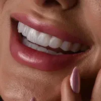 کامپوزیت و بلیچینگ