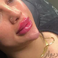 ژل لب|خدمات آرایشگری و زیبایی|اسلامشهر, شهرک مهدیه|دیوار