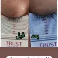 زیبایی و سلامتی پوست ومو|آرایشی، بهداشتی، درمانی|بابل, |دیوار