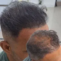 جشنواره فوق تخصصی میکرواسکالپ در شیراز