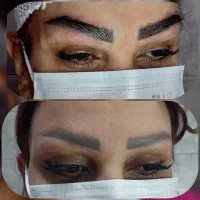 اموزش تزریقات زیبایی بوتاکس و فیلر و مزو|خدمات آموزشی|ارومیه, |دیوار