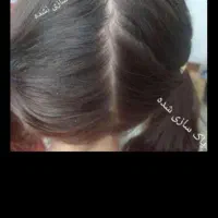 درمان قطعی رشک و شپش با ضمانت|آرایشی، بهداشتی، درمانی|سبزوار, امیر کبیر|دیوار