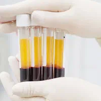 پی آر پی سوراخ کردن گوش آمبدینگ مزوتراپیPRPسابسیژن