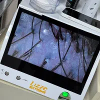 درمان تخصصی مشکلات پوست سر «اسکراب اسکالپ»