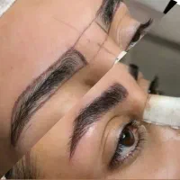 مدل ((رایگان)) میکروبلیدوفیبروزابرو