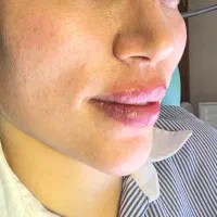 جشنواره کلینیک ژل و بوتاکس ۵۹۰|خدمات آرایشگری و زیبایی|اصفهان, خلجا|دیوار