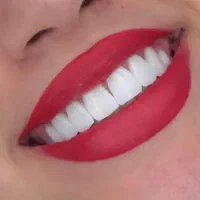 خدمات کامپوزیت،روکش،دندان مصنوعی|خدمات آرایشگری و زیبایی|چهاردانگه (تهران), |دیوار