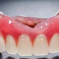 دندانسازی/دندان مصنوعی/دندان متحرک/دندان ژله ی
