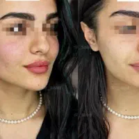 مدل رایگان دستگاه آراف جوان ساز ویا آبرسانی در مطب|خدمات آرایشگری و زیبایی|اصفهان, همدانیان|دیوار