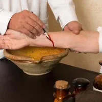 فصد پیشانی حجامت زالو درمانی|خدمات آرایشگری و زیبایی|ارومیه, |دیوار