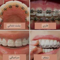 دندانپزشکی اقساطی(ارتودنسی-ایمپلنت-کامپوزیت)دندان|خدمات آرایشگری و زیبایی|مشهد, احمدآباد|دیوار