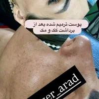 ریمولک تک جلسه ایی|خدمات آرایشگری و زیبایی|سرپل ذهاب, |دیوار