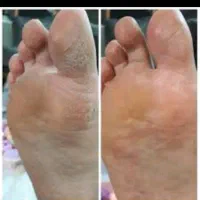 فیشیال تخصص و پدیکور و جوان سازی دست|خدمات آرایشگری و زیبایی|سرپل ذهاب, |دیوار