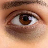 راهنمایی کنید برای دور چشم