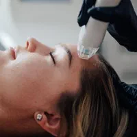 جوانسازی و لایه برداری پوست توسط پزشک