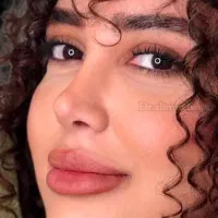 جراحی بینی و اصلاح تنفس متخصص ENT با 20 سال سابقه