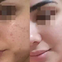 بزرگترین جشنواره تخفیفاتی بیوممتیک