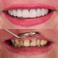 دندانپزشکی خیابان امام رضا