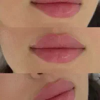 مدل خدمات زیبایی جهت عکاسی پیج