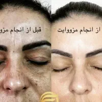 شید لب/رژلب/رفع لب تیره/مزووایت کرمپودر دایم|خدمات آرایشگری و زیبایی|اهواز, فرهنگ شهر|دیوار