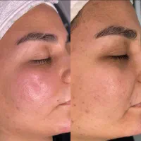فیشال تخصصیودرمانی ۳۰تا۴۰٪تخفیف واقعی فقط تادوشنبه