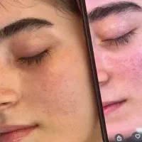 تخفیف محدود خدمات پاکسازی