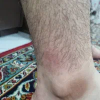 مشاوره درمانی|خدمات آرایشگری و زیبایی|شیراز, حافظیه|دیوار