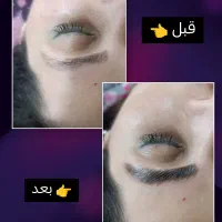 فیشال حرفه ای با دستگاه..|خدمات آرایشگری و زیبایی|گرگان, |دیوار