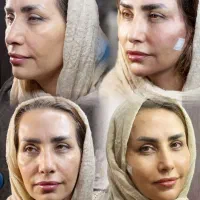 ارائه انواع خدمات زیبای درمطب توسط پزشک|خدمات آرایشگری و زیبایی|قم, امامزاده ابراهیم|دیوار