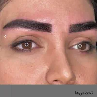 جشنواره کاشت و بلفاروپلاستی تضمینی