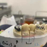 لابراتوار دندانسازی (روکش ثابت)|پزشکی|کرمانشاه, |دیوار